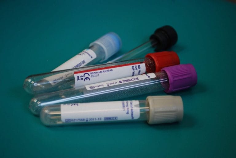 Ce analize medicale arată sănătatea rinichilor